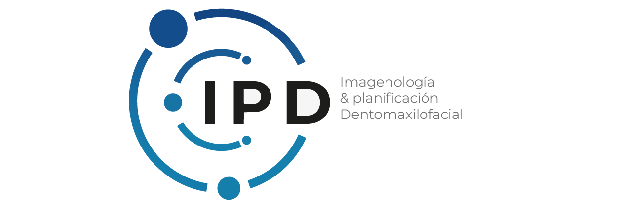ipd-01